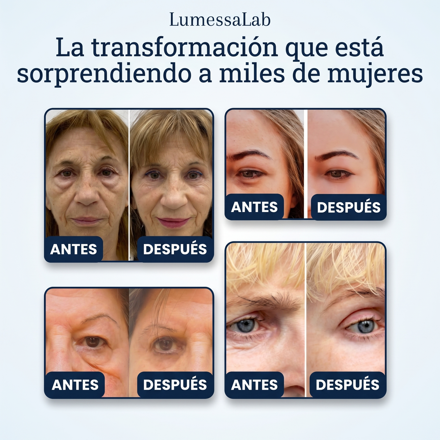 TensorEye™ – Elimina Ojeras y Bolsas