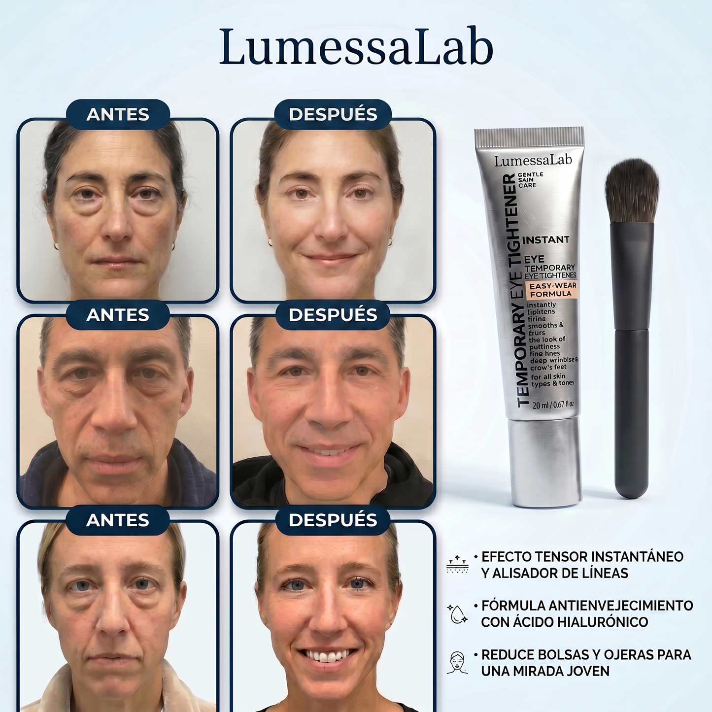 TensorEye™ – Elimina Ojeras y Bolsas